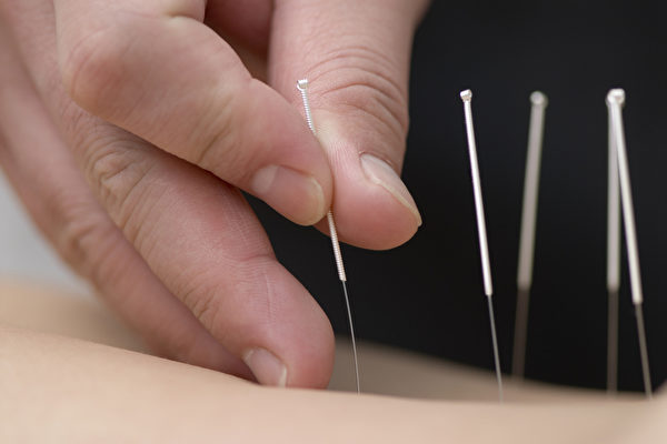 Acupuncture (internal medicine)